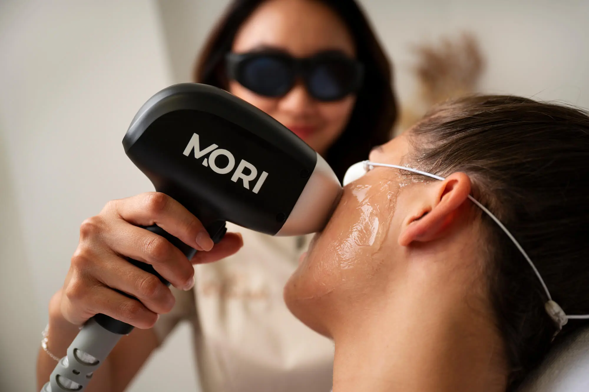 1x Gezicht laserontharing