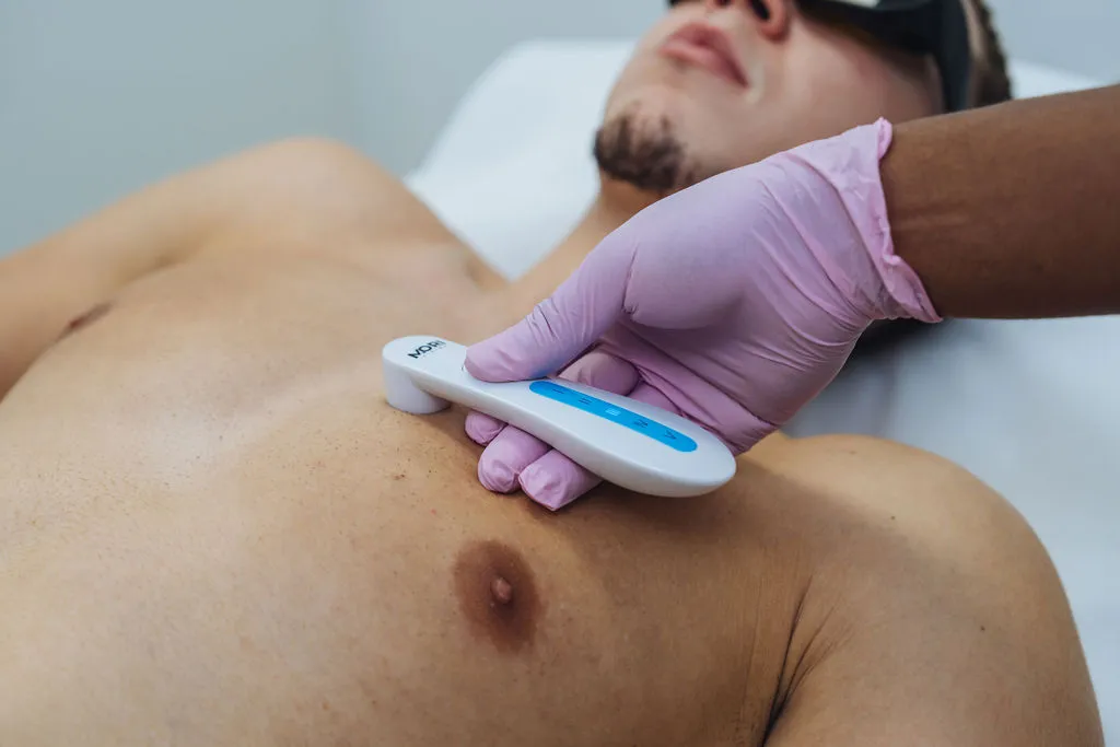 Schouders laserontharen voor mannen bij Gloow