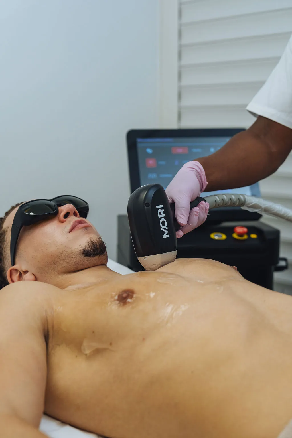 Laserbehandeling tijdens een full body traject bij Gloow